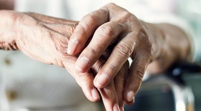 La relación entre la ansiedad y el Alzheimer