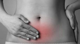 ¿Qué es la endometriosis?