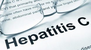 Mitos y verdades sobre la hepatitis C