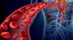 Angioplastia: todo lo que tienes que saber