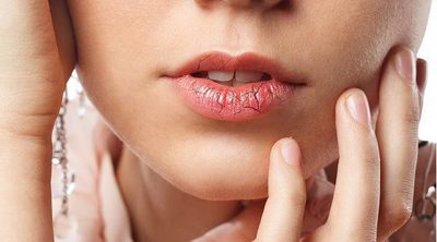 Labios cortados: por qué ocurre, prevención y remedios