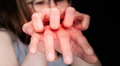 Consejos si tienes psoriasis