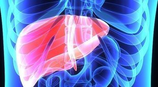 Hepatoesplenomegalia; cuando se hincha el hígado y el bazo