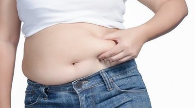 ¿Puedo hacer ejercicio si tengo obesidad?