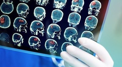 Cómo retrasar el envejecimiento cerebral