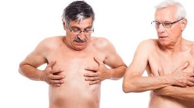 Bulto mamario en un hombre, ¿es posible?