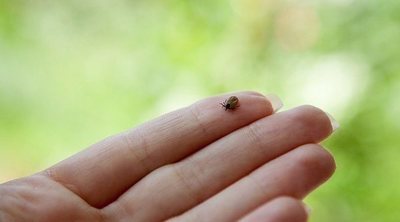 Pulgas en humanos, ¿qué hacer?